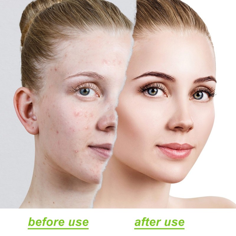 佰斯孚天然香料石竹烯在化妆品领域的应用CAS：1139-30-6